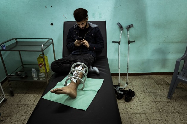 &copy; Darrian Traynor, from the series, 'More than skin deep'. GAZA. 3rd March 2020. 17-year-old Nasser Kheel was injured on 14th January 2019. Nasser says he wanted to go to the Great March of Return because his friends were going and he wanted to try it. He knew the risk, but didn&rsquo;t think he would be a target going for his first time.